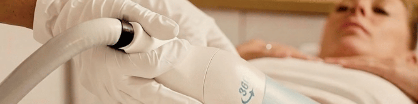 Fokus auf Kryolipolyse-Behandlung mit dem Cryomed-Handstück.